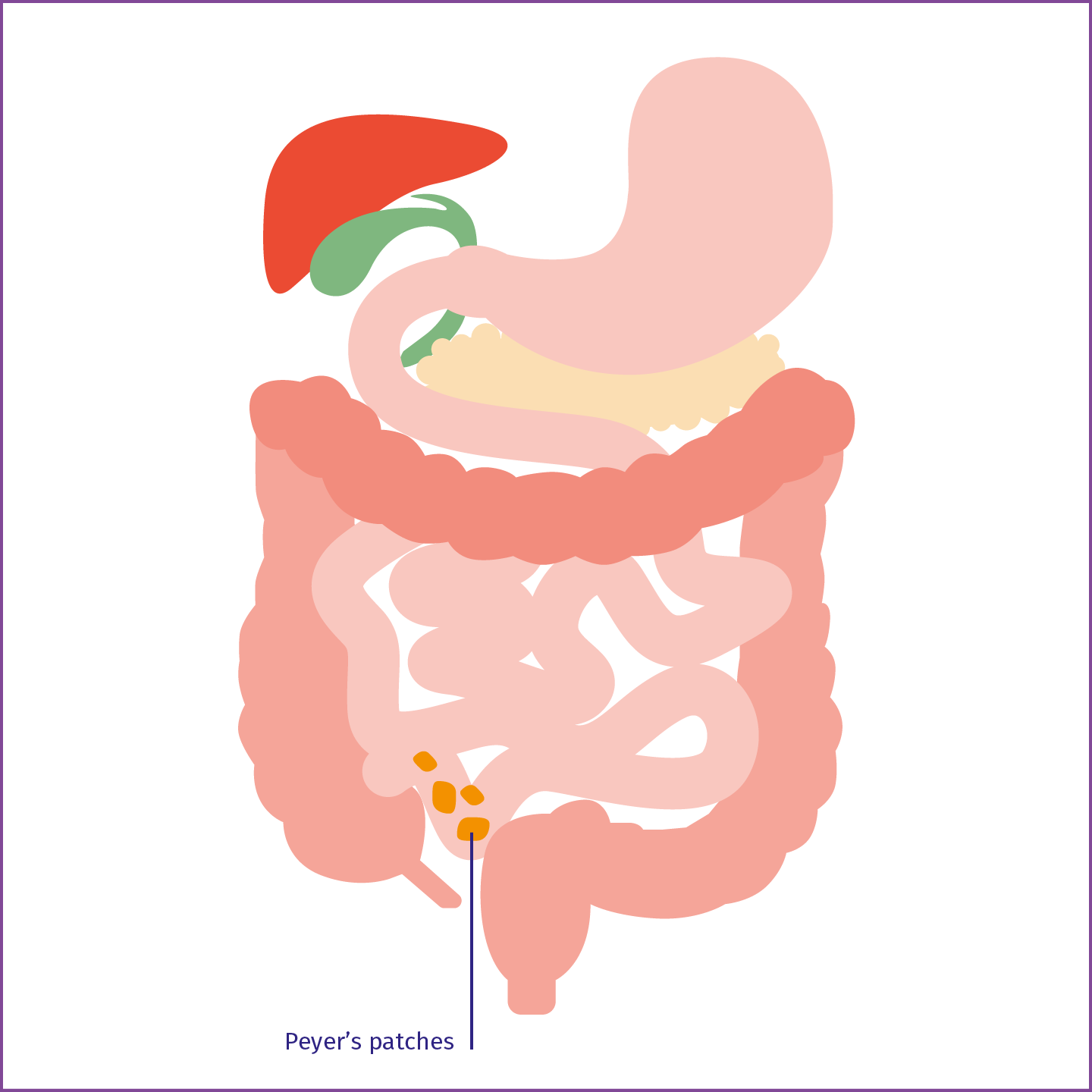 Illustration showing the location of Peyer's patches in the distal ileum