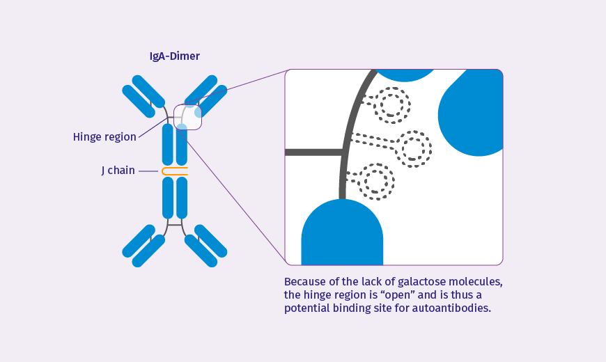 Illustration of the complex molecule with a hinge region that is “open” to autoantibodies.  The lack of galactose molecules mean that the hinge region is “open” and autoantibodies can bind to it.